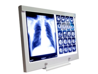 Extra flat viewbox LED 2 field 2 dimmers