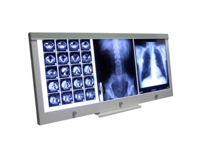 Extra flat viewbox LED 3 field 3 dimmers