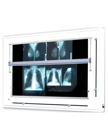 Négatoscope pour mammographies 12 clichés barre mobile
