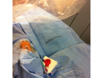 RADPAD champ absorbant anti-x 75% éq Pb 0,125mm 37x42cm accès radial sans plomb - stérile - bte de 15